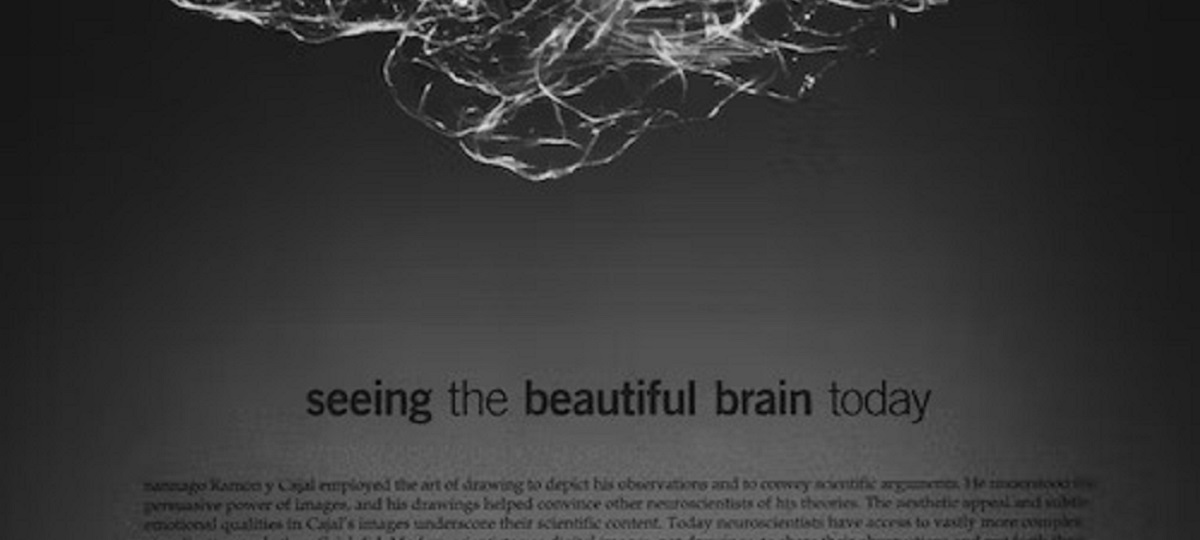 - An image of a brain scan showing the differences between a brain with dyslexia and a brain without dyslexia.