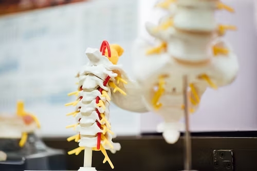 Managing pain in end-stage spinal stenosis.