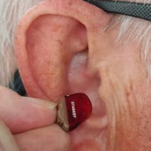 Man receiving ear seeding therapy for wellness