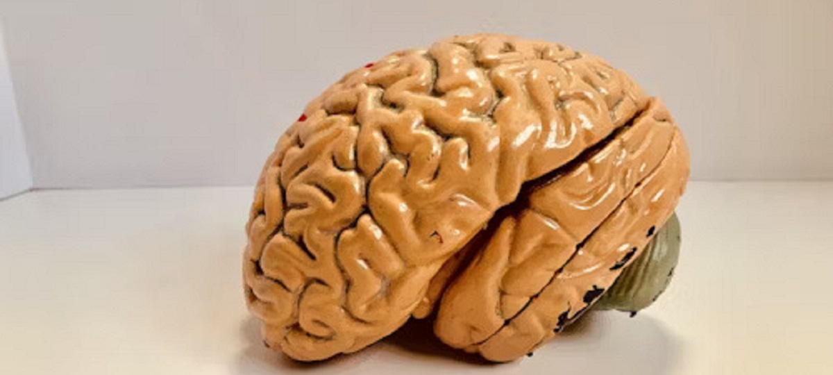 An MRI scan showing abnormal brain activity, representing various brain disorders such as Alzheimer's, Parkinson's, schizophrenia, epilepsy, and migraines.