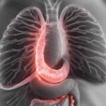 A medical imaging hida scan showing the liver, gallbladder, and bile ducts, used to diagnose conditions like gallbladder dysfunction and bile duct obstruction.